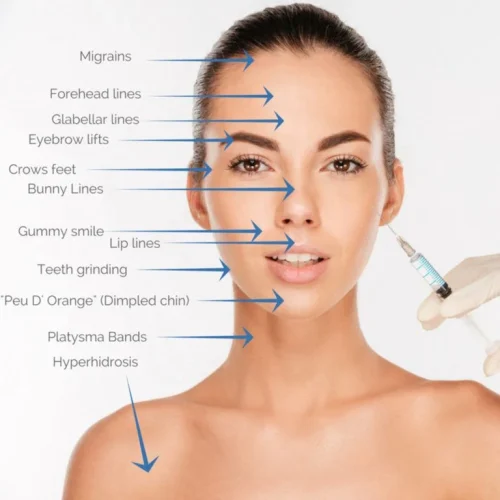 botox