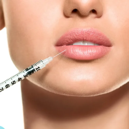 lip-injections